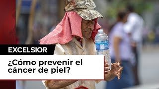 Factores de riesgo para el cáncer de piel [upl. by Namyaw620]