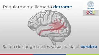 Hemorragia Cerebral ¿Qué es y cómo prevenirla  INCMNSZ  Educación para la Salud [upl. by Collin]