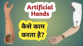 Types of High Technology Artificial Hand and Its Features myoelectric Hand Bionic Hand [upl. by Malinin42]