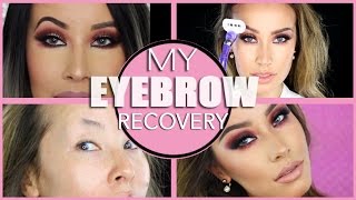 HOW TO FIX BOTCHED EYEBROWS  MY EYEBROW NIGHTMARE amp RECOVERY [upl. by Engelbert660]