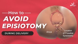 Why Episiotomy is Done  Reasons for Episiotomy During Delivery  Ankura Hospitals  shorts [upl. by Eniron999]