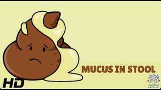 Mucus In Stool Everything You Need To Know [upl. by Dazhahs914]