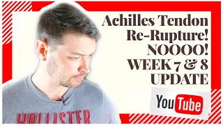 WEEK 7 amp 8 UPDATE II Achilles Tendon Rupture NonSurgical II Transition in shoes now [upl. by Yessej]