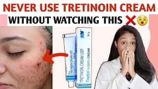 How to use TRETINOIN CREAM In Tamil TRETINOIN MISTAKES IN TAMIL [upl. by Materi770]