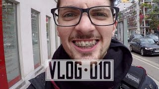 Getting My Braces ◈ Improving My VLOG ◈ New Gloves  CVLOG 10 [upl. by Tolman]