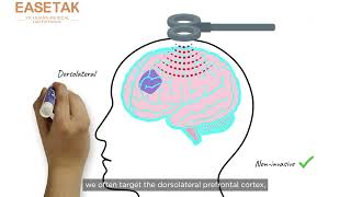 What is Transcranial Magnetic Stimulation [upl. by Neroc]