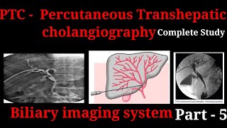 Percutaneous Transhepatic Cholangiography  PTC  Procedure  Biliary imaging system part  5 [upl. by Dnalel]