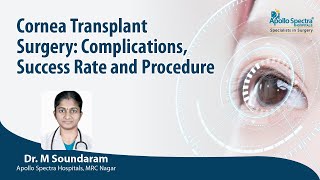 Cornea Transplant Surgery Complications Recovery amp Procedure by Dr Soundaram Apollo Spectra [upl. by Ninahs]