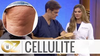 Home Treatment for Cellulite Effective Cupping Therapy Massage Techniques to Get Rid of Cellulite [upl. by Cleti123]