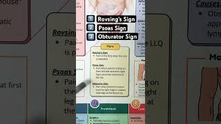 🔥 3 Signs of Appendicitis in 60 SECONDS Psoas Obturator Rovsing [upl. by Annola338]