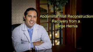 Recovery from Abdominal Hernia Surgery Abdominal Wall Reconstruction Large Hernia Followup [upl. by Mic]