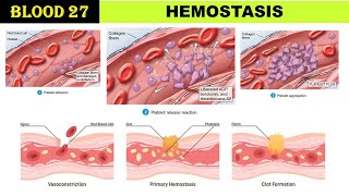 Hemostasis  Platelet plug formation  Vasoconstriction  Platelet release reaction  Injury [upl. by Ha813]