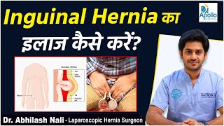 How to Treat Inguinal Hernia  Inguinal Hernia Symptoms and Treatment in Hindi  Dr Abhilash Nali [upl. by Means]