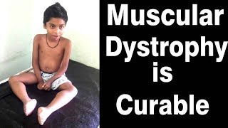 muscular dystrophy treatment in ayurveda  duchenne muscular dystrophy ayurvedic treatment [upl. by Docia]