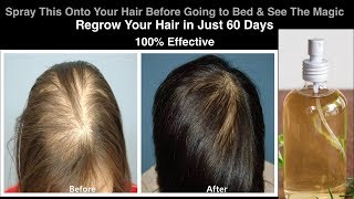 Spray this onto your hair before going to bed  Regrow your hair in just 60 days  Ginger Hair Spray [upl. by Anelah713]