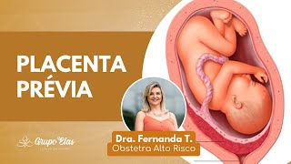 PLACENTA PRÉVIA  Dra Fernanda Torino  Ginecologia e Obstetrícia de Alto Risco [upl. by Baum125]