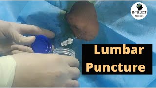 Lumbar Puncture Procedure in just 11 mins [upl. by Darryn252]