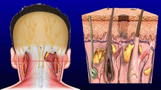 Swollen Occipital Lymph Node Causes And Treatment [upl. by Aiceled960]