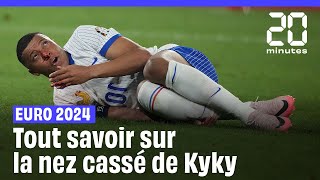 Euro 2024  Les images du nez cassé de Kylian Mbappé et tout savoir sur la suite [upl. by Temme]