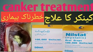 کنکر کا علاج نلسٹیٹ سے ۔Nilstat dropAseel jungal2024 [upl. by Nivel]