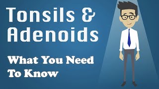 Tonsils and Adenoids  What You Need To Know [upl. by Skylar876]