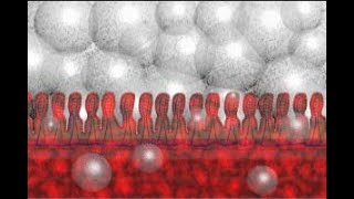 Necrotizing Enterocolitis NEC Part 2 Animation by Cal Shipley MD [upl. by Witha]