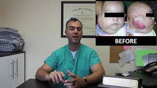 5 Things You Need to Know About Infantile Hemangioma [upl. by Eiba560]