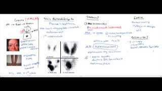 Hypothyroidism Hyperthyroidism Thyroid Storm for the USMLE [upl. by Ruggiero]