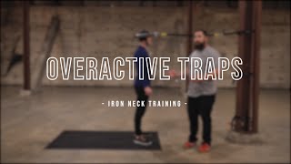 Overactive Traps  Iron Neck Training [upl. by Ordway]