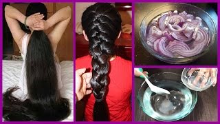 How to Grow Long Thicken Hair with Onion  Worlds Best Remedy for Hair Growth [upl. by Sternberg]