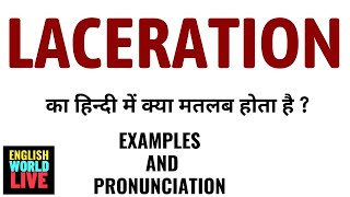 LACERATION MEANING IN HINDI  LACERATION का हिन्दी में क्या मतलब होता है  LACERATION IN HINDI [upl. by Carli536]