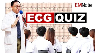 ECG Quiz for ACLS and Clinical Practice [upl. by Simmie]