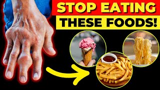 10 Most Dangerous Foods For Arthritis That You Often Overlook [upl. by Jd]