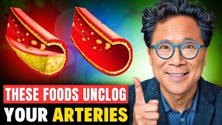 ANTIAGING Foods That UNCLOG Your ARTERIES💥 Dr William Li [upl. by Stevens371]