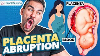 Placental Abruption Symptoms Causes Nursing Interventions  NCLEX Tips [upl. by Manolo]