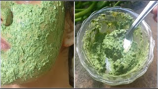 Remove your Pimples amp Body Acne permanently  Neem Face Pack for Acne Scars amp Hyperpigmentation [upl. by Shriver]