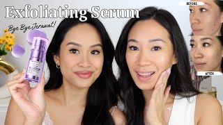 Skin Renewal Exfoliating Serum Bisa Sembuhin Jerawat PMS  Lactic Acid Serum [upl. by Moulden]