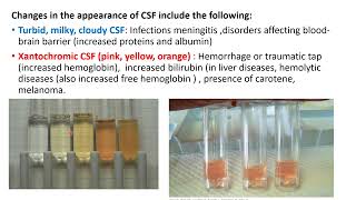 CSF analysis  Pediatric Neurology [upl. by Sankey839]