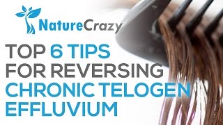 Nature Crazys Top 6 Tips For Reversing Chronic Telogen Effluvium [upl. by Amora835]