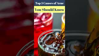 Top 5 Causes of Acne You Should Know – Dr Atif Kazmi Explains [upl. by Oab]