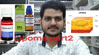 lipomaHomeopathic medicine for lipoma part 2 [upl. by Recor481]