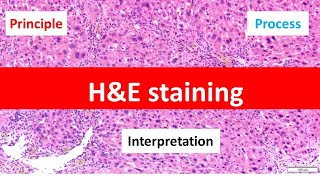 HE Staining Principle Procedure and Interpretation  Haematoxylin and Eosin Staining [upl. by Nilyac512]