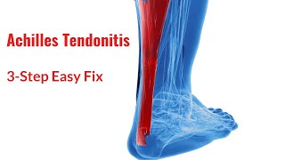 Achilles Tendonitis Fix in 3 Simple Steps [upl. by Kroy]