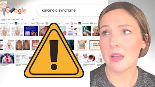 CARCINOID SYNDROME  Erythrophobia flushed skin chronic blushing  DO NOT GOOGLE [upl. by Asserrac]