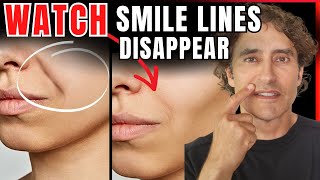 Nasolabial Folds DIY Hacks vs MedSpa Solutions [upl. by Enneyehs]