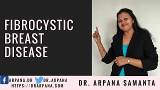 फ़िब्रोसिस्टिक ब्रैस्ट डिजीज के लक्षण और होम्योपैथिक दवाई  FIBROCYSTIC DISEASE amp Homeopathy [upl. by Nylodam]