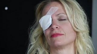 How to Apply an Eye Patch  Information on Eyes [upl. by Yessak]