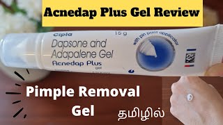 PRODUCT REVIEWEPI23ACNEDAP PLUS GEL REVIEWDAPSANE amp ADAPALENE GEL REVIEWPIMPLE REMOVAL GELACNE [upl. by Lefton]