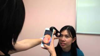 visoScope Smartphone Ophthalmoscope [upl. by Lardner]