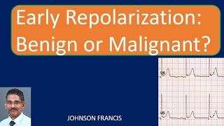 Early Repolarization Benign or Malignant [upl. by Oyr329]